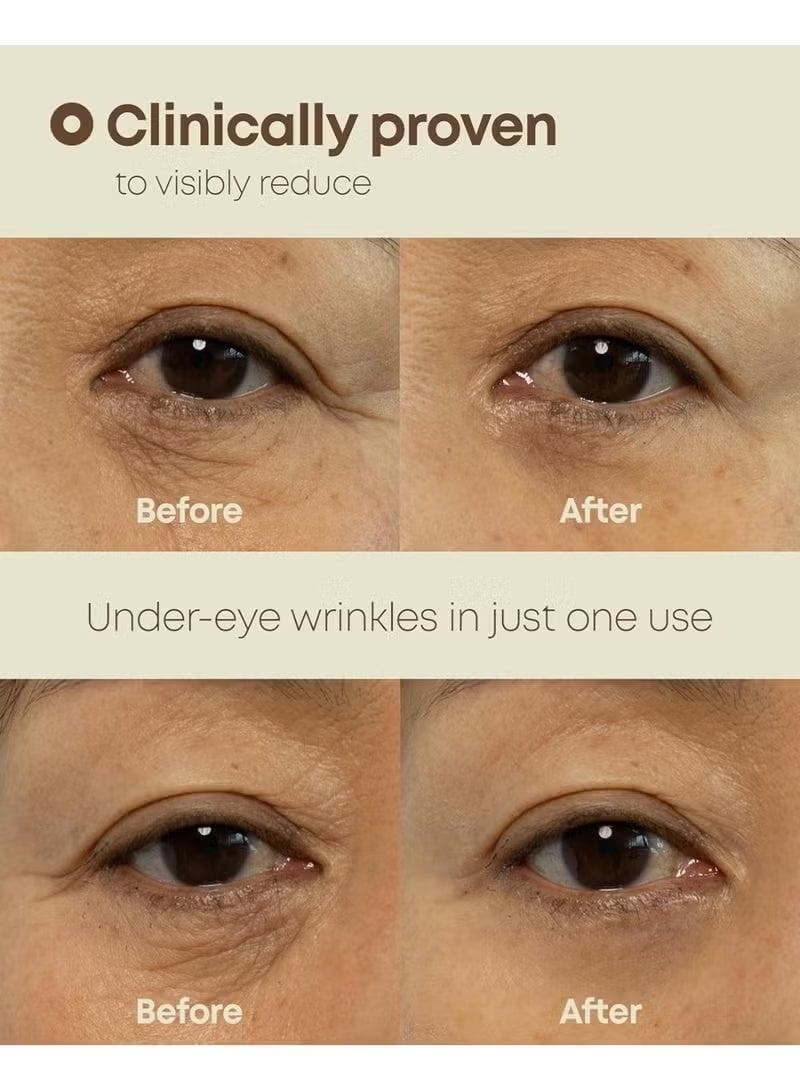 NINELESS NINE LESS-Ever-Youth Dual Effect Eye Cream 20ml - Image 2